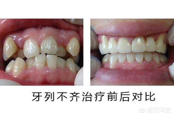 余姚最新24小时牙医在线咨询方法分析(最方便真实的余姚有没有24小时牙医方法)