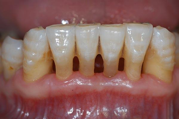 余姚最新24小时牙医在线咨询方法分析(最方便真实的余姚有没有24小时牙医方法)